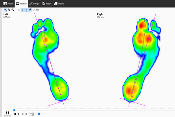 Foot data graph